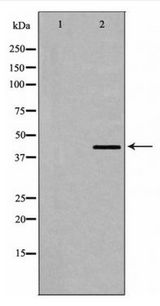 DMTN / Dematin Antibody - Western blot of Dematin expression in HeLa whole cell