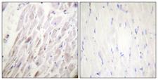 DMTN / Dematin Antibody - Immunohistochemistry analysis of paraffin-embedded human heart, using Dematin (Phospho-Ser403) Antibody. The picture on the right is blocked with the phospho peptide.