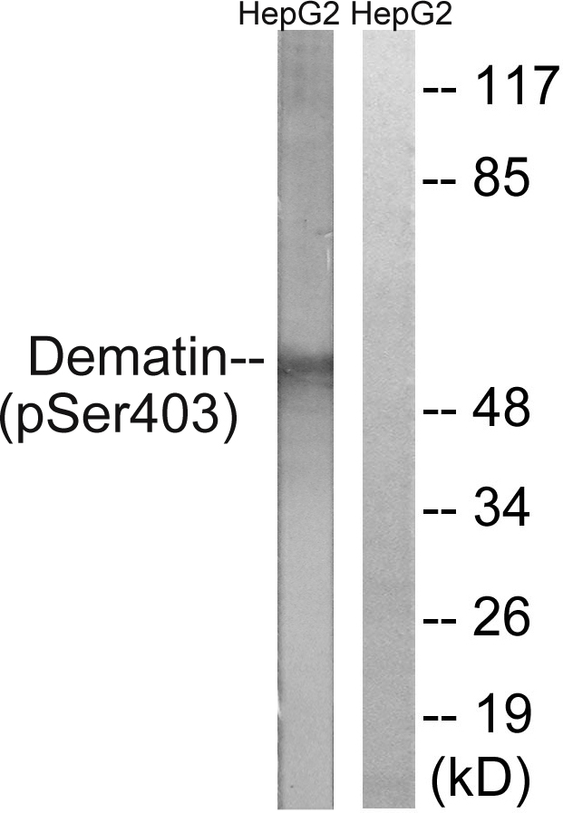 DMTN / Dematin Antibody - Western blot analysis of lysates from HepG2 cells treated with Insulin 0.01U/ml 15', using Dematin (Phospho-Ser403) Antibody. The lane on the right is blocked with the phospho peptide.