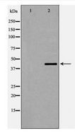 DMTN / Dematin Antibody - Western blot of Dematin (Phospho-Ser403) expression in HeLa whole cell