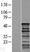 DMTN / Dematin Protein - Western validation with an anti-DDK antibody * L: Control HEK293 lysate R: Over-expression lysate