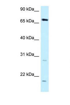 DMWD Antibody - DMWD antibody Western blot of MCF7 Cell lysate. Antibody concentration 1 ug/ml.  This image was taken for the unconjugated form of this product. Other forms have not been tested.