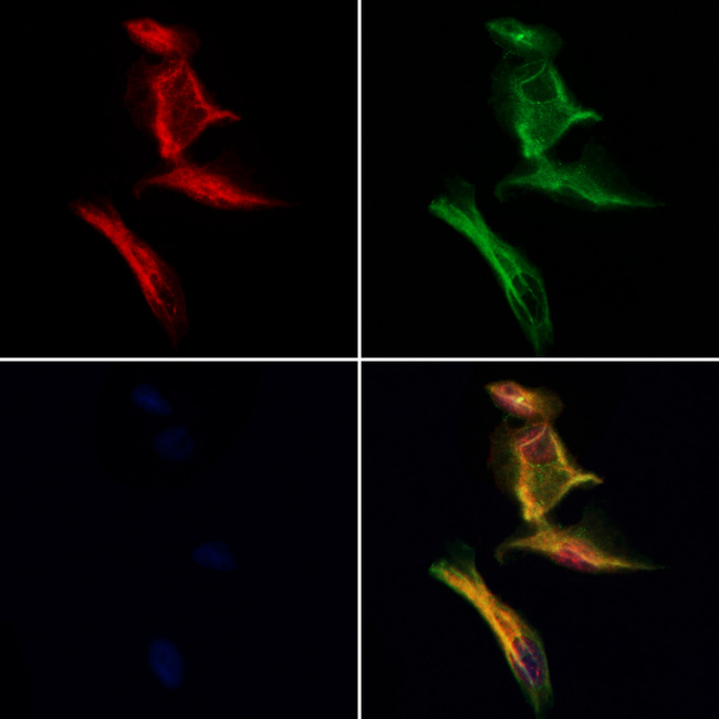 DMXL2 Antibody - Staining HeLa cells by IF/ICC. The samples were fixed with PFA and permeabilized in 0.1% Triton X-100, then blocked in 10% serum for 45 min at 25°C. Samples were then incubated with primary Ab(1:200) and mouse anti-beta tubulin Ab(1:200) for 1 hour at 37°C. An AlexaFluor594 conjugated goat anti-rabbit IgG(H+L) Ab(1:200 Red) and an AlexaFluor488 conjugated goat anti-mouse IgG(H+L) Ab(1:600 Green) were used as the secondary antibod