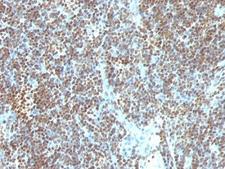 DNA ds Antibody - Formalin-fixed, paraffin-embedded human tonsil stained with Double Stranded DNA antibody (SPM603).  This image was taken for the unmodified form of this product. Other forms have not been tested.