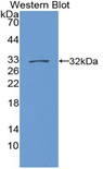 DNA Topoisomerase II Antibody - Western blot of recombinant DNA Topoisomerase II.