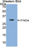 DNA Topoisomerase II Antibody - Western blot of recombinant DNA Topoisomerase II.  This image was taken for the unconjugated form of this product. Other forms have not been tested.