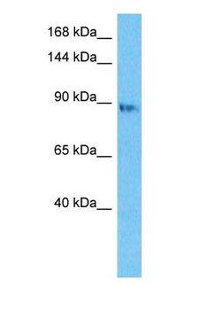 DNA2 Antibody - Western blot of DNA2 Antibody with human Jurkat Whole Cell lysate.  This image was taken for the unconjugated form of this product. Other forms have not been tested.