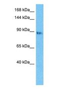 DNA2 Antibody - Western blot of DNA2 Antibody with human Jurkat Whole Cell lysate.  This image was taken for the unconjugated form of this product. Other forms have not been tested.