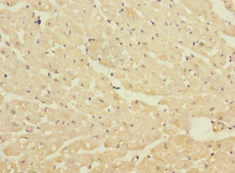 DNA2 Antibody - Immunohistochemistry of paraffin-embedded human heart tissue using DNA2 Antibody at dilution of 1:100