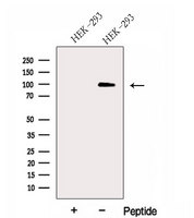 DNAAF5 / HEATR2 Antibody - Western blot analysis of extracts of HEK293 cells using HEATR2 antibody. The lane on the left was treated with blocking peptide.