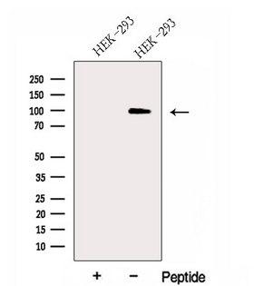 DNAAF5 / HEATR2 Antibody - Western blot analysis of extracts of HEK293 cells using HEATR2 antibody. The lane on the left was treated with blocking peptide.