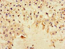 DNAH1 Antibody - Immunohistochemistry of paraffin-embedded human placenta tissue at dilution of 1:100