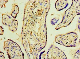 DNAH3 Antibody - Immunohistochemistry of paraffin-embedded human placenta tissue using antibody at 1:100 dilution.  This image was taken for the unconjugated form of this product. Other forms have not been tested.