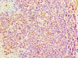 DNAH3 Antibody - Immunohistochemistry of paraffin-embedded human tonsil tissue using antibody at 1:100 dilution.  This image was taken for the unconjugated form of this product. Other forms have not been tested.