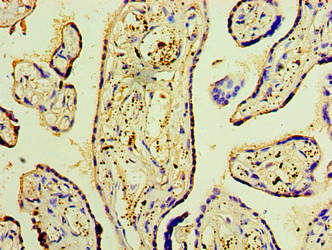 DNAH3 Antibody - Immunohistochemistry of paraffin-embedded human placenta tissue using DNAH3 Antibody at dilution of 1:100