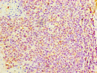 DNAH3 Antibody - Immunohistochemistry of paraffin-embedded human tonsil tissue using DNAH3 Antibody at dilution of 1:100