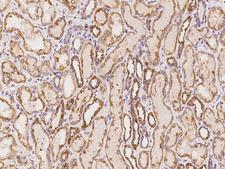 DNAH8 Antibody - Immunochemical staining of human DNAH8 in human kidney with rabbit polyclonal antibody at 1:1000 dilution, formalin-fixed paraffin embedded sections.