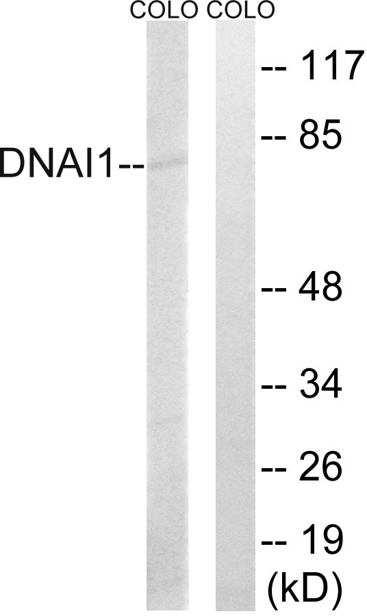 DNAI1 Antibody - Western blot analysis of lysates from COLO cells, using DNAI1 Antibody. The lane on the right is blocked with the synthesized peptide.
