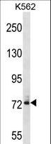 DNAI1 Antibody - DNAI1 Antibody western blot of K562 cell line lysates (35 ug/lane). The DNAI1 antibody detected the DNAI1 protein (arrow).