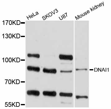 DNAI1 Antibody - Western blot analysis of extracts of various cell lines, using DNAI1 antibody at 1:1000 dilution. The secondary antibody used was an HRP Goat Anti-Rabbit IgG (H+L) at 1:10000 dilution. Lysates were loaded 25ug per lane and 3% nonfat dry milk in TBST was used for blocking. An ECL Kit was used for detection and the exposure time was 10s.