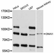 DNAI1 Antibody - Western blot analysis of extracts of various cell lines, using DNAI1 antibody at 1:1000 dilution. The secondary antibody used was an HRP Goat Anti-Rabbit IgG (H+L) at 1:10000 dilution. Lysates were loaded 25ug per lane and 3% nonfat dry milk in TBST was used for blocking. An ECL Kit was used for detection and the exposure time was 10s.