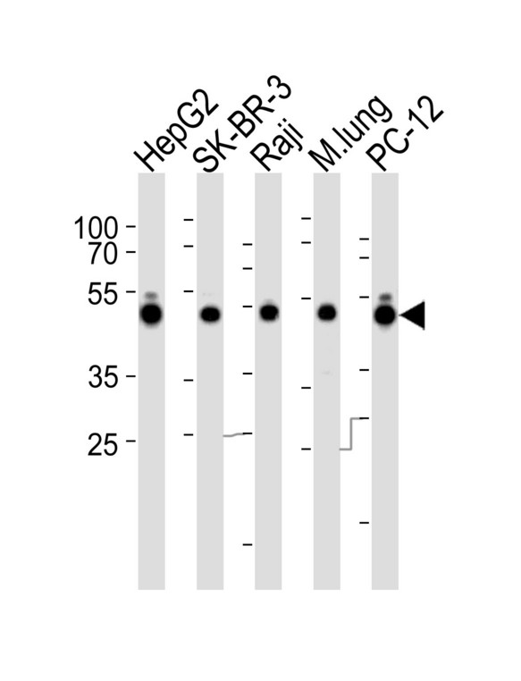 DNAJA1 / HDJ2 Antibody - Western blot of lysates from HepG2, SK-BR-3, Raji cell line, mouse lung tissue lysate and rat PC-12 cell line (from left to right) with DNAJA1 Antibody. Antibody was diluted at 1:1000 at each lane. A goat anti-rabbit IgG H&L (HRP) at 1:5000 dilution was used as the secondary antibody. Lysates at 35 ug per lane.