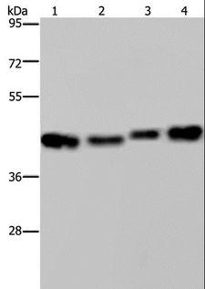 DNAJA1 / HDJ2 Antibody - Western blot analysis of HepG2, Raji, A431 and 231 cell, using DNAJA1 Polyclonal Antibody at dilution of 1:800.