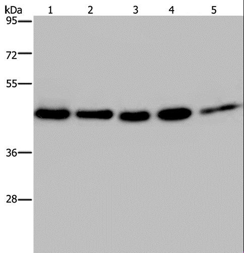 DNAJA1 / HDJ2 Antibody - Western blot analysis of 231, A431, Raji, Jurkat and HepG2 cell, using DNAJA1 Polyclonal Antibody at dilution of 1:500.