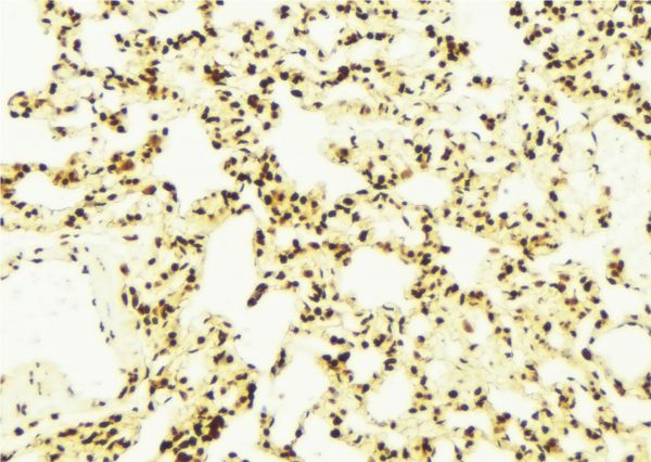 DNAJA1 / HDJ2 Antibody - 1:100 staining mouse lung tissue by IHC-P. The sample was formaldehyde fixed and a heat mediated antigen retrieval step in citrate buffer was performed. The sample was then blocked and incubated with the antibody for 1.5 hours at 22°C. An HRP conjugated goat anti-rabbit antibody was used as the secondary.