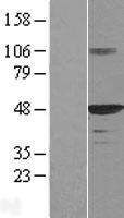 DNAJA1 / HDJ2 Protein - Western validation with an anti-DDK antibody * L: Control HEK293 lysate R: Over-expression lysate