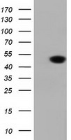 DNAJA2 Antibody - HEK293T cells were transfected with the pCMV6-ENTRY control (Left lane) or pCMV6-ENTRY DNAJA2 (Right lane) cDNA for 48 hrs and lysed. Equivalent amounts of cell lysates (5 ug per lane) were separated by SDS-PAGE and immunoblotted with anti-DNAJA2.