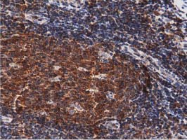 DNAJA2 Antibody - IHC of paraffin-embedded Human lymph node tissue using anti-DNAJA2 mouse monoclonal antibody. (Dilution 1:50).