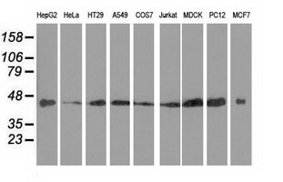 DNAJA2 Antibody - Western blot of extracts (35 ug) from 9 different cell lines by using anti-DNAJA2 monoclonal antibody.