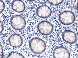 DNAJA2 Antibody - IHC of paraffin-embedded Human colon tissue using anti-DNAJA2 mouse monoclonal antibody. (Dilution 1:50).