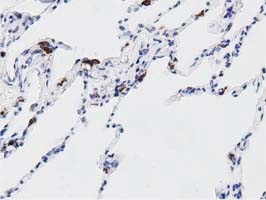 DNAJA2 Antibody - IHC of paraffin-embedded Human lung tissue using anti-DNAJA2 mouse monoclonal antibody. (Dilution 1:50).