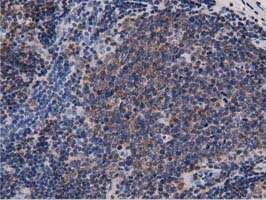 DNAJA2 Antibody - IHC of paraffin-embedded Human lymph node tissue using anti-DNAJA2 mouse monoclonal antibody. (Dilution 1:50).