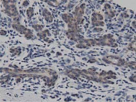DNAJA2 Antibody - IHC of paraffin-embedded Human breast tissue using anti-DNAJA2 mouse monoclonal antibody. (Dilution 1:50).