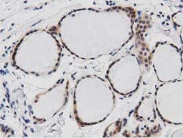 DNAJA2 Antibody - IHC of paraffin-embedded Human thyroid tissue using anti-DNAJA2 mouse monoclonal antibody. (Dilution 1:50).