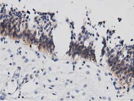 DNAJA2 Antibody - IHC of paraffin-embedded Human bladder tissue using anti-DNAJA2 mouse monoclonal antibody. (Dilution 1:50).