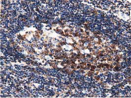 DNAJA2 Antibody - IHC of paraffin-embedded Human lymph node tissue using anti-DNAJA2 mouse monoclonal antibody.