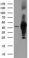 DNAJA2 Antibody - HEK293T cells were transfected with the pCMV6-ENTRY control (Left lane) or pCMV6-ENTRY DNAJA2 (Right lane) cDNA for 48 hrs and lysed. Equivalent amounts of cell lysates (5 ug per lane) were separated by SDS-PAGE and immunoblotted with anti-DNAJA2.