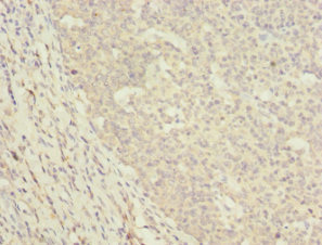 DNAJA2 Antibody - Immunohistochemistry of paraffin-embedded human tonsil tissue at dilution 1:100