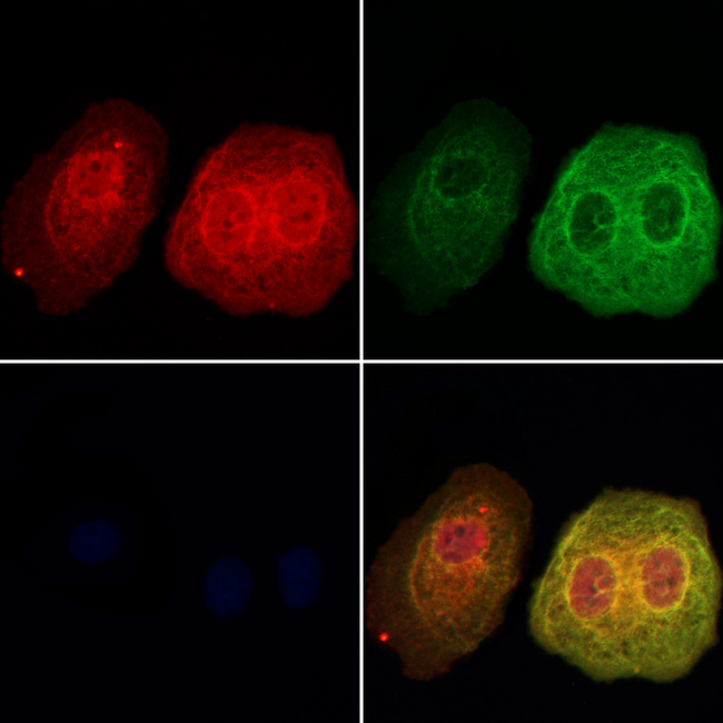 DNAJA2 Antibody - Staining HeLa cells by IF/ICC. The samples were fixed with PFA and permeabilized in 0.1% Triton X-100, then blocked in 10% serum for 45 min at 25°C. Samples were then incubated with primary Ab(1:200) and mouse anti-beta tubulin Ab(1:200) for 1 hour at 37°C. An AlexaFluor594 conjugated goat anti-rabbit IgG(H+L) Ab(1:200 Red) and an AlexaFluor488 conjugated goat anti-mouse IgG(H+L) Ab(1:600 Green) were used as the secondary antibod