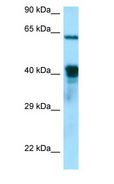 DNAJA3 / TID1 Antibody - DNAJA3 / TID1 antibody Western Blot of Jurkat.  This image was taken for the unconjugated form of this product. Other forms have not been tested.