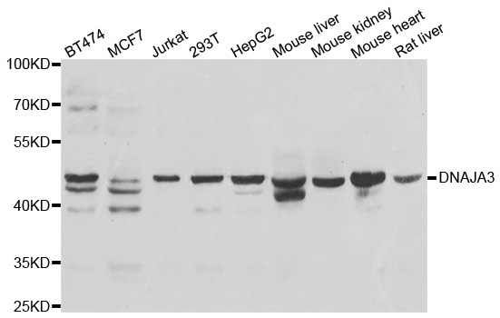 DNAJA3 / TID1 Antibody - Western blot analysis of extracts of various cell lines.