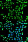 DNAJA3 / TID1 Antibody - Immunofluorescence analysis of U2OS cells using DNAJA3 Polyclonal Antibody.