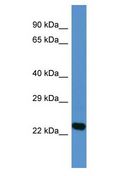 DNAJA4 Antibody - DNAJA4 antibody Western Blot of Jurkat. Antibody dilution: 1 ug/ml.  This image was taken for the unconjugated form of this product. Other forms have not been tested.