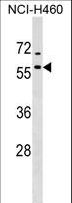 DNAJA4 Antibody - DNAJA4 Antibody western blot of NCI-H460 cell line lysates (35 ug/lane). The DNAJA4 antibody detected the DNAJA4 protein (arrow).