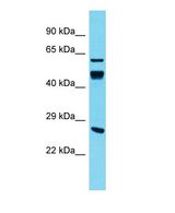 DNAJA4 Antibody - Western blot of Dnaja4 Antibody - C-terminal region in Rat Spleen cells lysate.  This image was taken for the unconjugated form of this product. Other forms have not been tested.