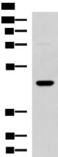 DNAJA4 Antibody - Western blot analysis of TM4 cell lysate  using DNAJA4 Polyclonal Antibody at dilution of 1:800